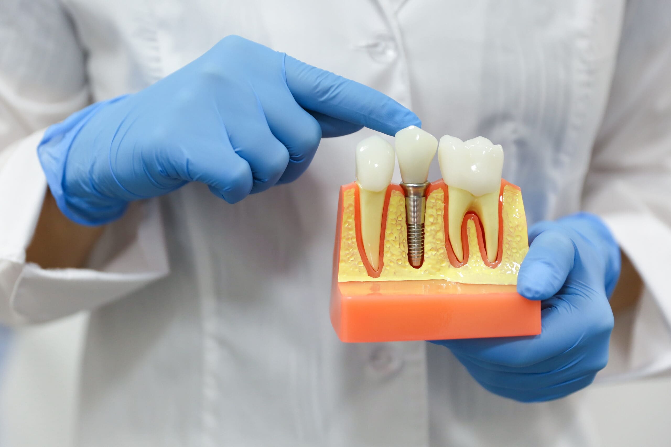 dental concept. the hands of a dentist doctor hold a model of te